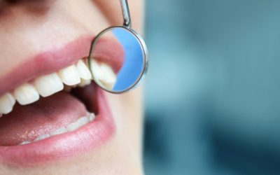 Come risparmiare dal dentista: Convenzioni e Agevolazioni