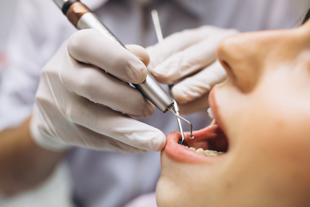 Igienista dentale a Cagliari